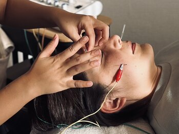 パリワール(pariwar)の写真/《最強エイジングケア》美容鍼×インディバの独自手技で結果重視の根本改善で10年後も美しく。