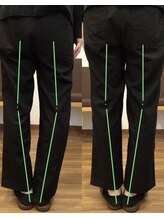 ハーベスト治療院/O脚矯正