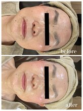 ジャスミン(Jasmin)/エステティック×シェービング