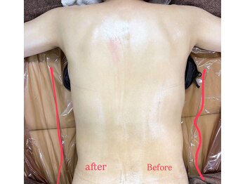 リュシータ 吹田千里丘店(LUSHEETA)/【 VENUS痩身 】(50代前半)