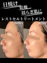 ノーブルノアール(Noble noir)/くすみ/糖化ケア