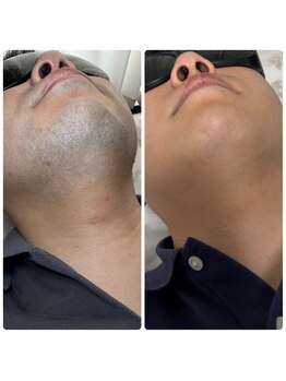 アプロディタ/ご覧ください！この美肌！