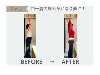 整体院 欅/整体効果 肩の可動域制限