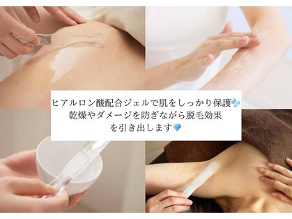 脱毛専門サロン エリクサー(Elixir)の写真