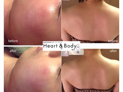 ハートアンドボディ 烏丸店(Heart&Body)の写真