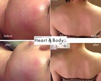 ハートアンドボディ 烏丸店(Heart&Body)