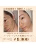 ◆7月特別クーポン◆圧倒的艶肌!ハーブピーリング+W高濃度ビタミンC導入