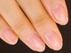 ネイルセラピーサロン プラムジュース(Nail Therapy Salon Plum Juice)の写真/どんなトラブルネイルも、専門知識のあるスタッフがしっかりとケア★貴女の地爪を本来の美しさに導きます♪
