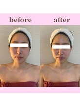 ココ(COCO)/お客様ビフォーアフター