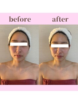 ココ(COCO)/お客様ビフォーアフター