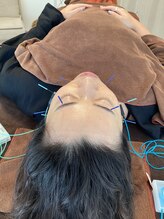 ハリファ鍼灸院 横浜関内院(HariFa鍼灸院)/美容施術