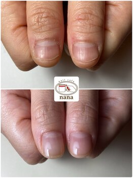 ネイルカフェ ナナ(nailcafe'nana)/自爪育成
