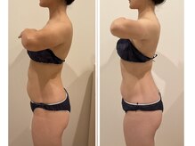 TMサロン 赤坂/姿勢/背肉/お腹/首肩同時ケア