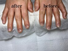 ペル(Per)/ハンドケアのビフォーアフター