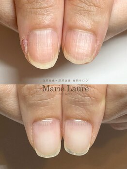 マリーロール 淀屋橋本店(Marie Laure)/深爪矯正/自爪育成/ネイルケア