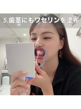 ホワイトニングショップ 刈谷店/5.歯茎にもワセリンを塗布