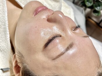 ニュアージュ(Nuage)の写真/何年も悩んでいる毛穴、自己流で良くならないニキビや赤みに!レストセル・IPL・各種トリートメント取扱☆