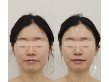 ケイビューティーサロン(K BeautySalon)/韓国本場リガメントコルギ