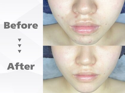 アンドミー 恵比寿店(&me)の写真