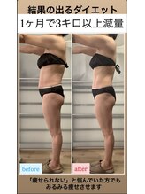 ユノン(yunon)/ビフォーアフター