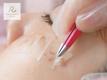 ボーテドリッシュ(Beaute de Riche)の写真/予約殺到!結果出し追求ボーテドリッシュ独自メソッド×【ホワイトラボ】でシミの根源を徹底改善!!