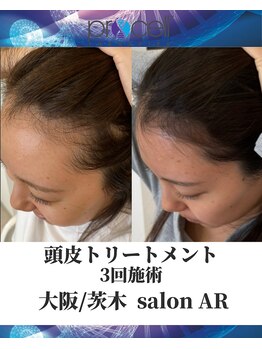 メンズサロンアール(AR)/プロセルセラピーズ