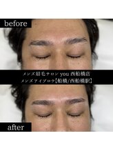 ユー 西船橋店(you)/ビフォーアフター写真