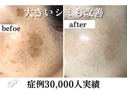 パールホワイトニングサロン 大和店の写真