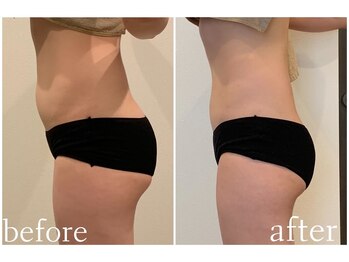 エニ 恵比寿(eni)/腰周りのビフォーアフター