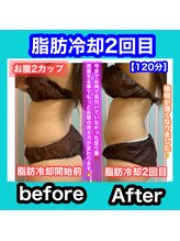 ビューティ ウィッチ(Beauty Witch)/