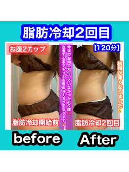 ビューティ ウィッチ(Beauty Witch)/