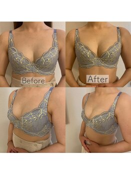 エレナ 伊勢崎(Ele'na)/バストケア1回施術前後