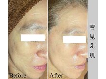 ブラックボックス(BLACK BOX)/結果にこだわるメニュー