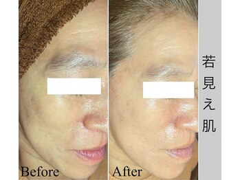 ブラックボックス(BLACK BOX)/結果にこだわるメニュー