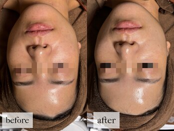 ヒナノ 矢場町店(HINANO)/クリスティーナビオフィート