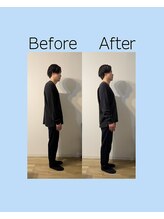 ヨスガ(YoSuGa)/姿勢矯正ビフォーアフター