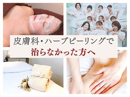 アクール(Accueil)の写真