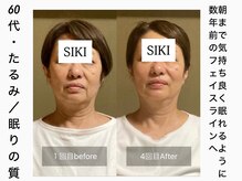 シキ(SIKI)の雰囲気（スッキリ綺麗なフェイスラインに！【小顔調整/巻肩/肩こり】）