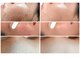 ナンバーフォーティーン(No.14)の写真