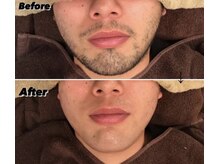 ダウニー(Downy)/20代/男性/中学教師