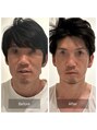 クレール(clair) 脳洗浄100分3回の変化