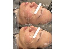 エムズセレクトケア(M's select care)の雰囲気（【エンビロン くすみケアコース】ビタミンA導入で驚きの結果に◎）