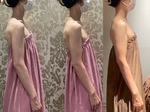 ロココ 横浜店(Rococo)/【巻肩改善に感動！】