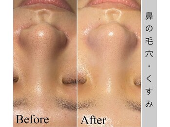 ブラックボックス(BLACK BOX)/20代女性のお客様