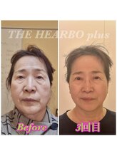 ハーボプラス(THE HEARBO plus)/歪みが整いました！