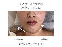 TD 清洲店/光フェイシャル