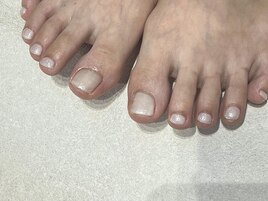 white × foot