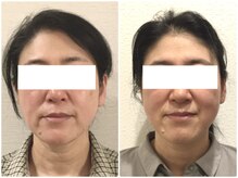 美容整体 ウェリナ 蟹江院/小顔矯正/骨盤矯正/美脚サロン