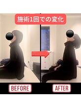 整体 寿 横浜院(KOTOBUKI)/横浜/横浜市/整体/肩こり