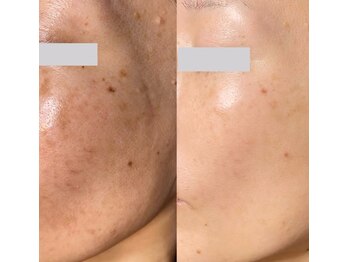 エルア 尼崎(Elua)/